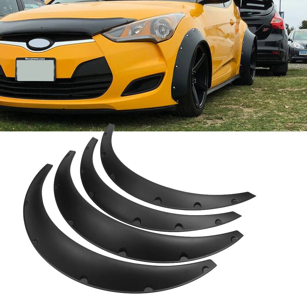 For Hyundai Veloster Tires Fender Flares Over Wide Body Wheel Arches Flexible 4X